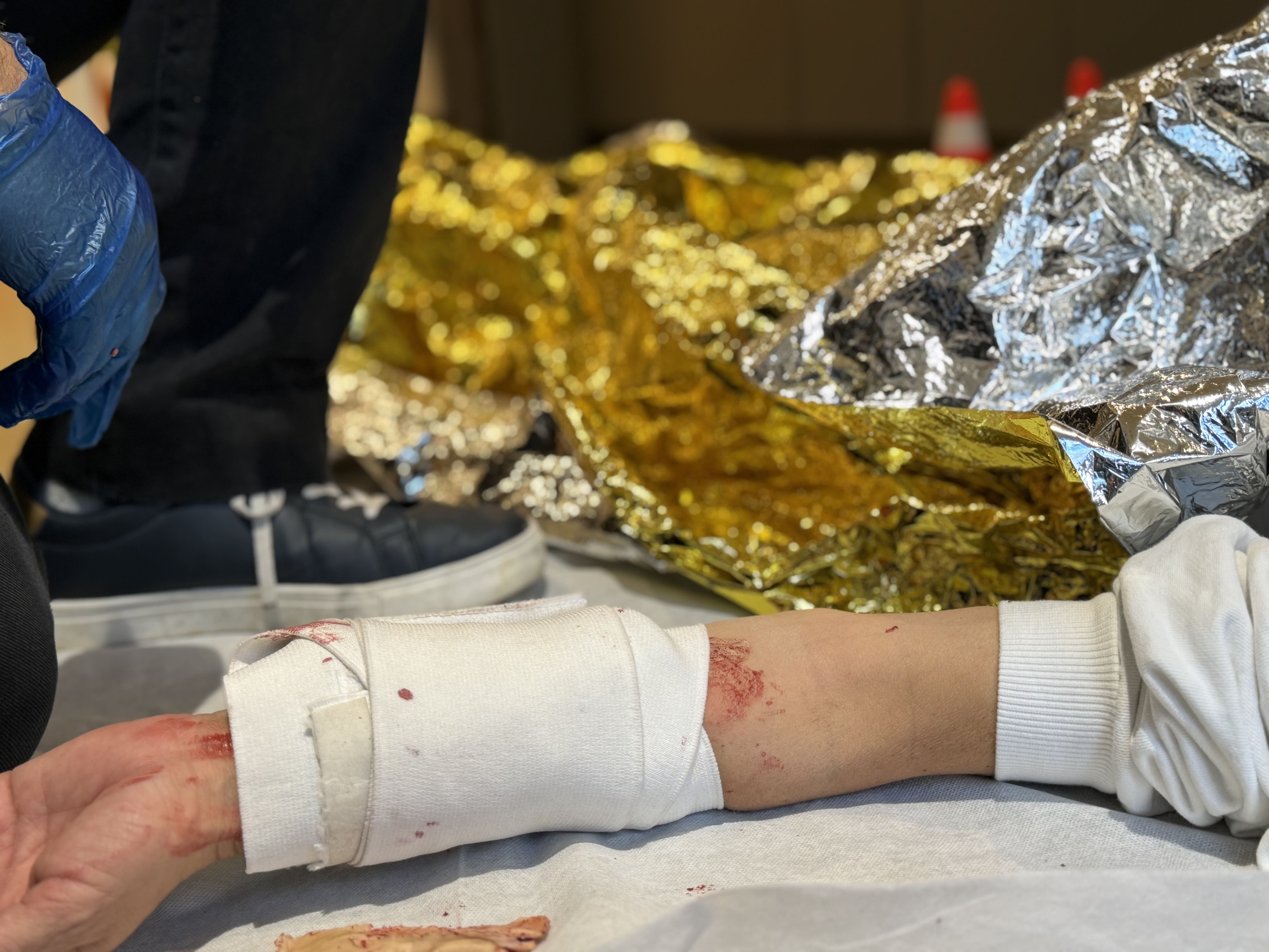 Main avec bandage et traces de sang